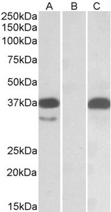 PIM2 / Pim-2 Antibody - HEK293 lysate (10ug protein in RIPA buffer) overexpressing Human PIM2 with C-terminal MYC tag probed with (0.1ug/ml) in Lane A and probed with anti-MYC Tag (1/1000) in lane C. Mock-transfected HEK293 probed (0.1mg/ml) in Lane B. Detec
