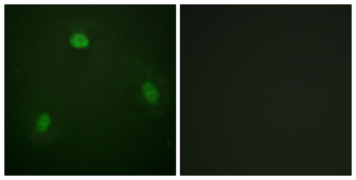 PIN1 Antibody - Immunofluorescence analysis of NIH/3T3 cells, using Pin1 Antibody. The picture on the right is blocked with the synthesized peptide.
