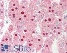 PIN1 Antibody - Anti-PIN1 antibody IHC staining of human adrenal. Immunohistochemistry of formalin-fixed, paraffin-embedded tissue after heat-induced antigen retrieval. Antibody dilution 1:500.