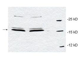 PIN1 Antibody - Anti-Pin1 Antibody - Western Blot. Western blot of affinity purified anti-Pin1 antibody to detect endogenous Pin1 in HeLa whole cell lysates. The sample was run in duplicate. A band representing Pin1 is indicated by the arrowhead. Cell lysates were electrophoresed using a straight 15% polyacrylamide gel, followed by transfer to nitrocellulose. The membrane was probed with the primary antibody at a 1:700 dilution. A 1:5000 dilution of HRP Gt-a-Rabbit IgG (LS-C60865) was used with a 15 sec exposure time. Personal Communication, L. D'Agostino and A. Giordano, SHRO, Philadelphia, PA.