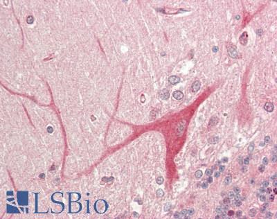 PINK1 Antibody - Human Brain, Cerebellum: Formalin-Fixed, Paraffin-Embedded (FFPE).  This image was taken for the unconjugated form of this product. Other forms have not been tested.