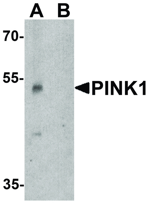 PINK1 Antibody - Western blot analysis of PINK1 in A431 cell lysate with PINK1 antibody at 1 ug/ml in (A) the absence and (B) the presence of blocking peptide.