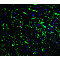 PINK1 Antibody - Immunofluorescence of PINK1 in mouse brain tissue with PINK1 Antibodyat 20 µg/mL. Green: PINK1 antibody  Red: Phylloidin staining Blue: DAPI staining