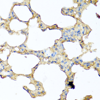 PIP / GCDFP-15 Antibody - Immunohistochemistry of paraffin-embedded mouse lung tissue.