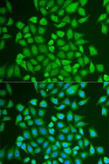 PIP / GCDFP-15 Antibody - Immunofluorescence analysis of U2OS cells.
