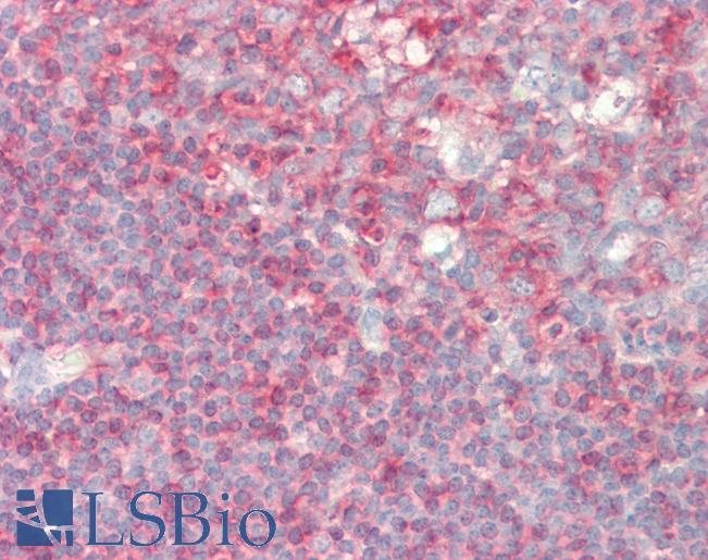 PIP5K1A Antibody - Anti-PIP5K1A antibody IHC staining of human tonsil. Immunohistochemistry of formalin-fixed, paraffin-embedded tissue after heat-induced antigen retrieval. Antibody concentration 5 ug/ml.