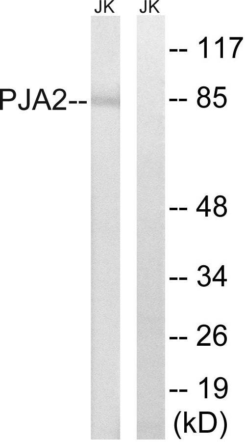 PJA2 Antibody - Western blot analysis of lysates from Jurkat cells, using PJA2 Antibody. The lane on the right is blocked with the synthesized peptide.