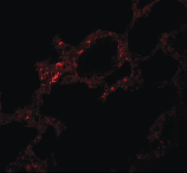 PKDCC / SGK493 Antibody - Immunofluorescence of VLK in rat lung tissue with VLK antibody at 5 ug/ml.