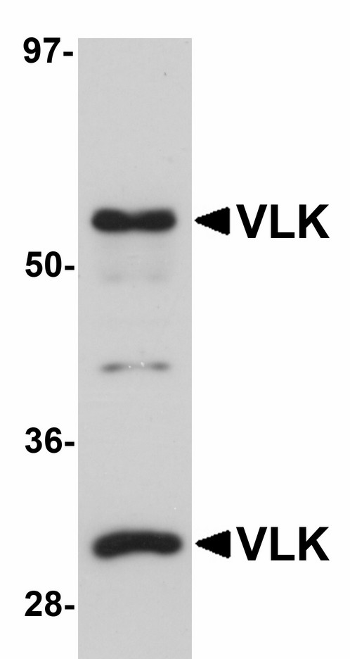 PKDCC / SGK493 Antibody - Western blot of VLK in human lung tissue lysate with VLK antibody at 1 ug/ml.