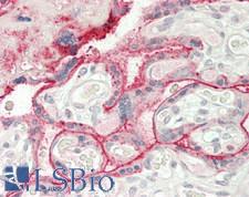 PKG / PRKG1 Antibody - Human Placenta: Formalin-Fixed, Paraffin-Embedded (FFPE)