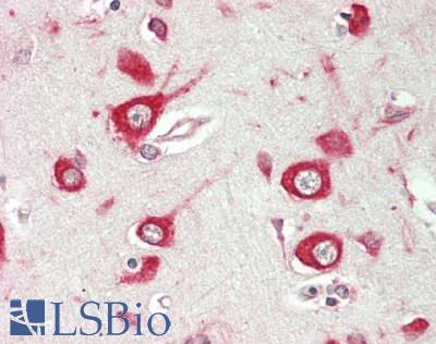 PKIB Antibody - Human Brain, Cortex: Formalin-Fixed, Paraffin-Embedded (FFPE)