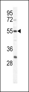 PKM / Pyruvate Kinase, Muscle Antibody - Western blot of PKM1 antibody (C-term L398) in HeLa cell line lysates (35 ug/lane). PKM1 (arrow) was detected using the purified antibody.