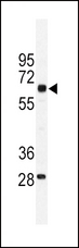PKM / Pyruvate Kinase, Muscle Antibody - Western blot of PKM1 antibody (C-term L398) in mouse testis tissue lysates (35 ug/lane). PKM1 (arrow) was detected using the purified antibody.