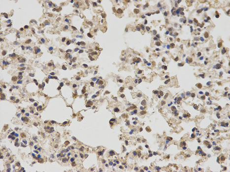 PKM / Pyruvate Kinase, Muscle Antibody - Immunohistochemistry of paraffin-embedded mouse lung using PKM2 antibody at dilution of 1:100 (400x lens).