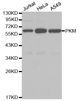 PKM / Pyruvate Kinase, Muscle Antibody - Western blot analysis of extracts of various cell lines, using PKM antibody at 1:1000 dilution. The secondary antibody used was an HRP Goat Anti-Rabbit IgG (H+L) at 1:10000 dilution. Lysates were loaded 25ug per lane and 3% nonfat dry milk in TBST was used for blocking.