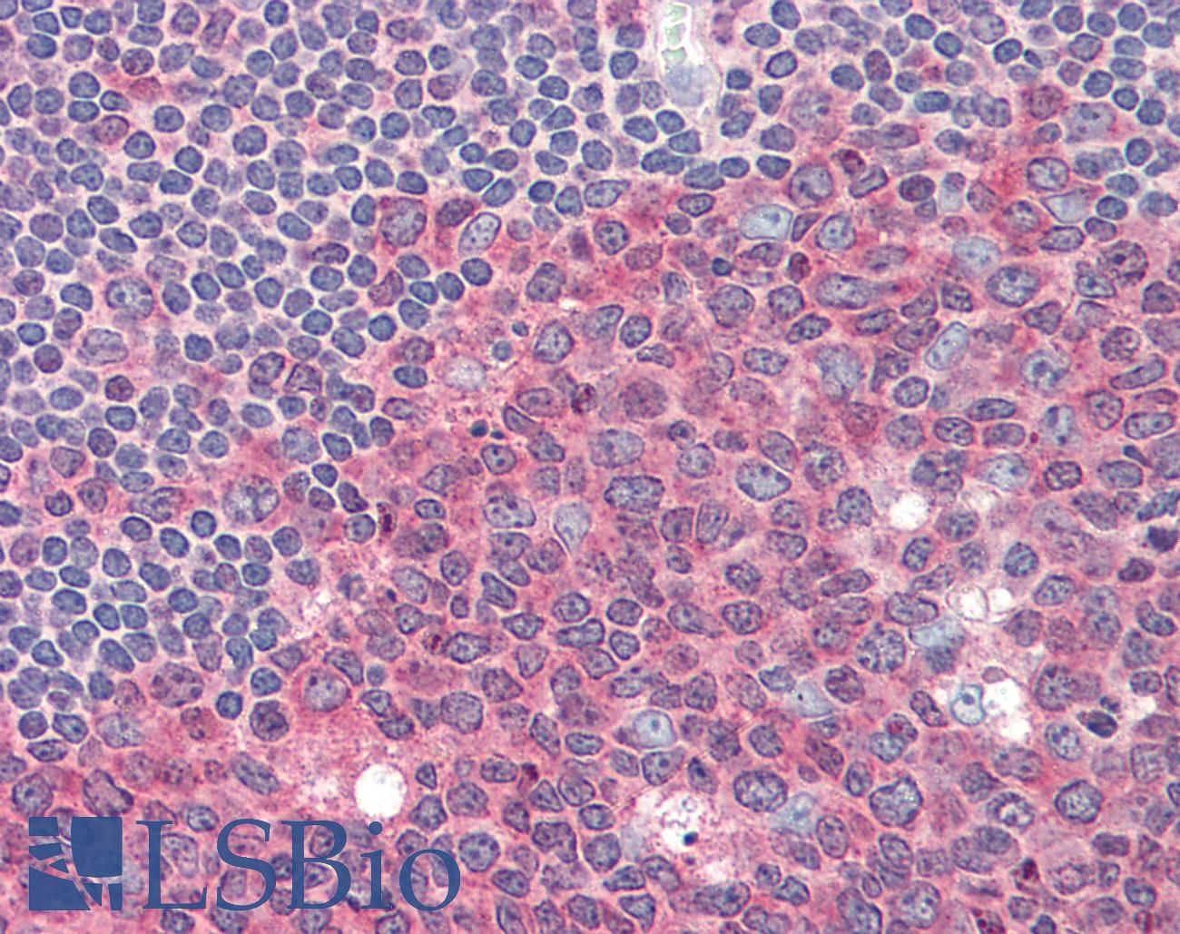 PKM / Pyruvate Kinase, Muscle Antibody - Anti-PKM2 antibody IHC of human tonsil. Immunohistochemistry of formalin-fixed, paraffin-embedded tissue after heat-induced antigen retrieval. Antibody dilution 1:100.