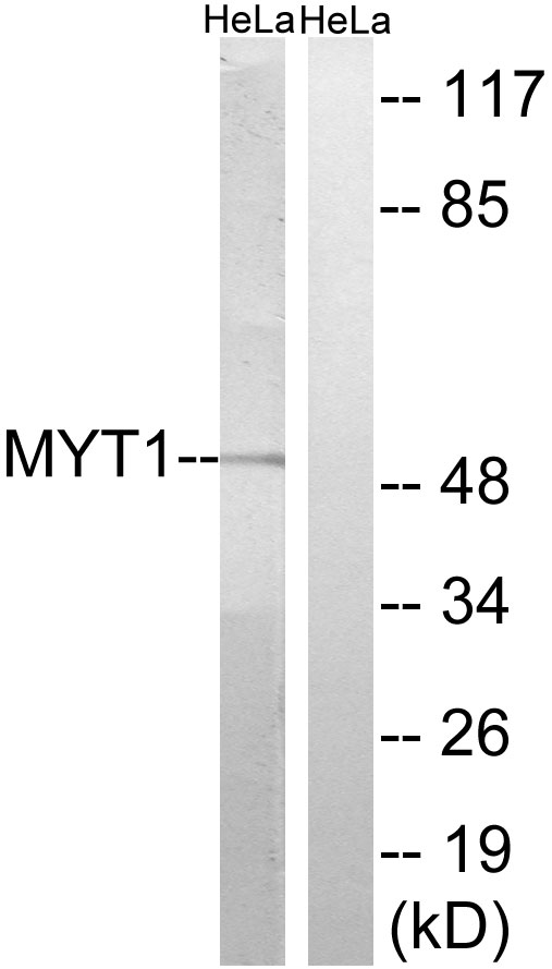 PKMYT1 Antibody - Western blot analysis of lysates from HeLa cells, using MYT1 Antibody. The lane on the right is blocked with the synthesized peptide.