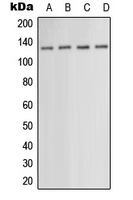 PKN1 Antibody - Western blot analysis of PKN1 expression in HEK293T (A); HepG2 (B); SP2/0 (C); NIH3T3 (D) whole cell lysates.