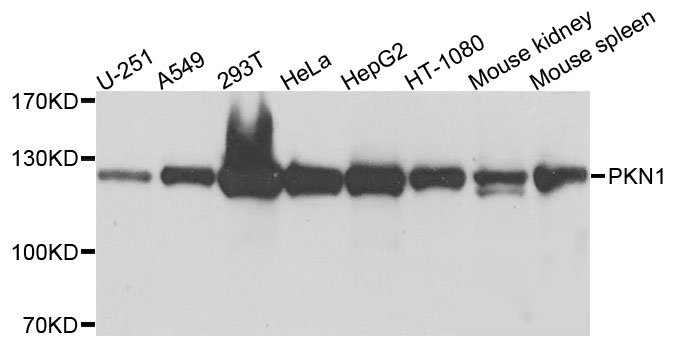 PKN1 Antibody - Western blot analysis of extracts of various cell lines, using PKN1 antibody at 1:1000 dilution. The secondary antibody used was an HRP Goat Anti-Rabbit IgG (H+L) at 1:10000 dilution. Lysates were loaded 25ug per lane and 3% nonfat dry milk in TBST was used for blocking. An ECL Kit was used for detection and the exposure time was 5s.
