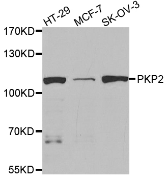 PKP2 / Plakophilin 2 Antibody - Western blot analysis of extracts of various cell lines.