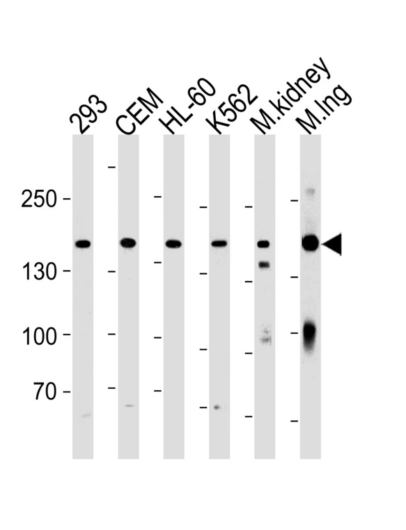PKP4 / Plakophilin 4 Antibody - PKP4 Antibody western blot of 293,CEM,HL-60,K562 cell line and mouse kidney,lung tissue lysates (35 ug/lane). The PKP4 antibody detected the PKP4 protein (arrow).