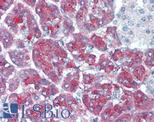 PLA2G1B Antibody - Human Pancreas: Formalin-Fixed, Paraffin-Embedded (FFPE)