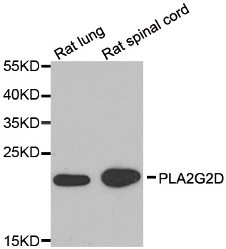 PLA2G2D Antibody - Western blot analysis of extracts of various cell lines.