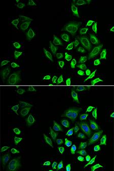 PLA2G2D Antibody - Immunofluorescence analysis of U2OS cells.