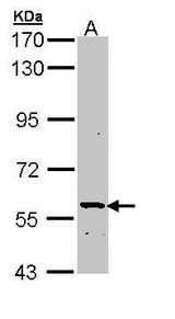 PLA2G3 Antibody - Sample (30 ug of whole cell lysate). A: Molt-4 . 7.5% SDS PAGE. PLA2G3 antibody diluted at 1:1000.