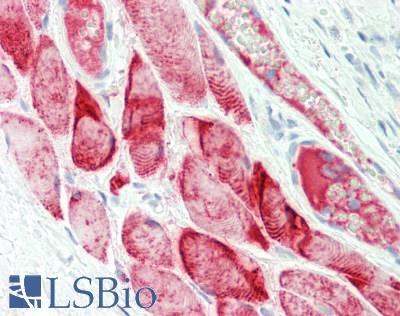 PLA2G3 Antibody - Human Tonsil, Skeletal Myocytes: Formalin-Fixed, Paraffin-Embedded (FFPE)