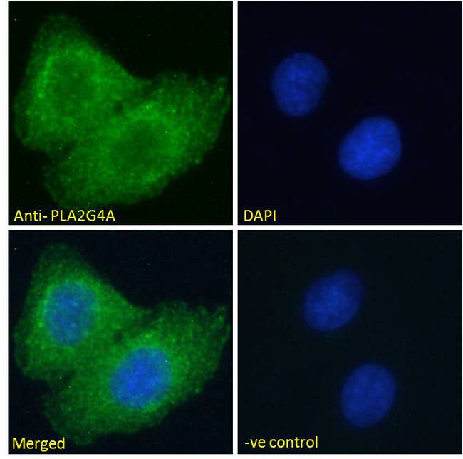 PLA2G4A Antibody - PLA2G4A antibody immunofluorescence analysis of paraformaldehyde fixed A549 cells, permeabilized with 0.15% Triton. Primary incubation 1hr (10ug/ml) followed by Alexa Fluor 488 secondary antibody (2ug/ml), showing cytoplasmic staining. The nuclear stain is DAPI (blue). Negative control: Unimmunized goat IgG (10ug/ml) followed by Alexa Fluor 488 secondary antibody (2ug/ml).