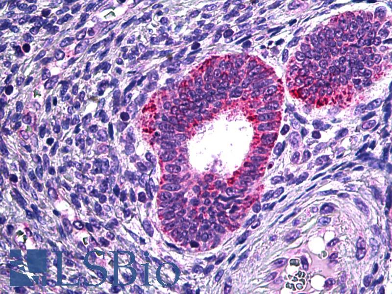 PLA2G4A Antibody - Anti-PLA2G4A antibody IHC of human uterus. Immunohistochemistry of formalin-fixed, paraffin-embedded tissue after heat-induced antigen retrieval. Antibody concentration 3.75 ug/ml.