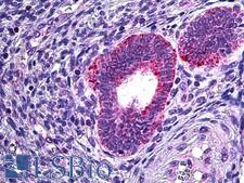 PLA2G4A Antibody - Anti-PLA2G4A antibody IHC of human uterus. Immunohistochemistry of formalin-fixed, paraffin-embedded tissue after heat-induced antigen retrieval. Antibody concentration 3.75 ug/ml.