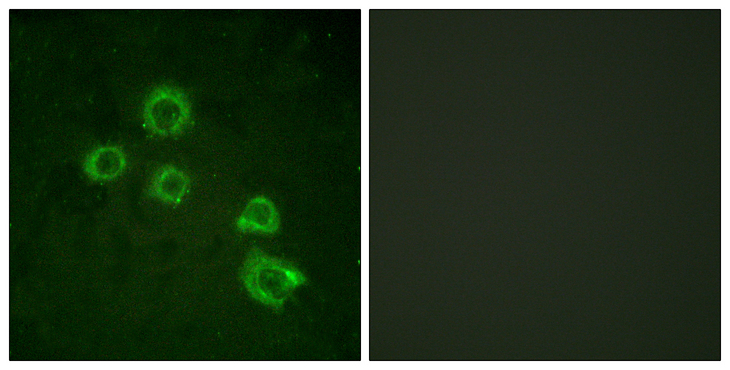 PLA2G4A Antibody - Immunofluorescence analysis of HUVEC cells, using c-PLA2 Antibody. The picture on the right is blocked with the synthesized peptide.