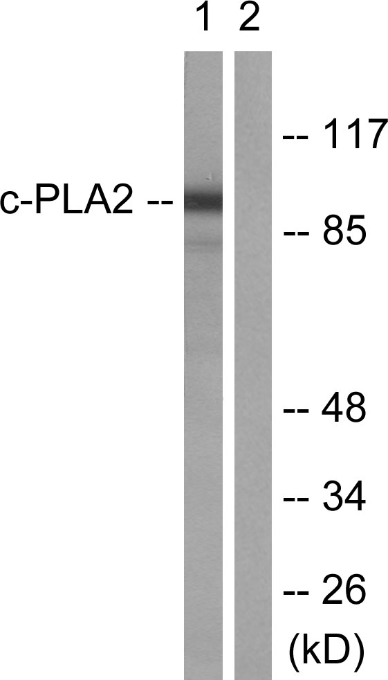 PLA2G4A Antibody - Western blot analysis of lysates from HeLa cells, treated with TNF-a 20ng/ml 30', using c-PLA2 Antibody. The lane on the right is blocked with the synthesized peptide.