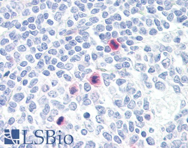 PLA2G4A Antibody - Anti-PLA2G4A antibody IHC of human tonsil, mitotic figures. Immunohistochemistry of formalin-fixed, paraffin-embedded tissue after heat-induced antigen retrieval. Antibody dilution 1:100.