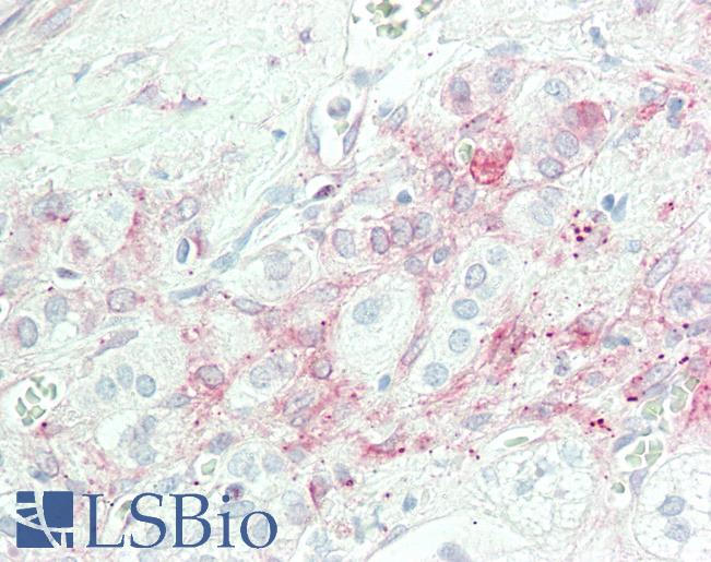 PLA2G4A Antibody - Anti-cPLA2 antibody IHC staining of human adrenal. Immunohistochemistry of formalin-fixed, paraffin-embedded tissue after heat-induced antigen retrieval. Antibody dilution 1:100.