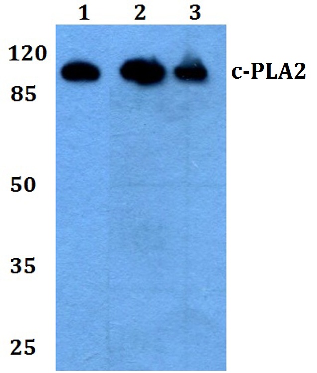 PLA2G4A Antibody - Western blot anylsis of c-PLA2 pAb at a 1:500 dilution. Lane 1: HEK293T whoe cell lysate. Lane 2: Raw264.7 whole cell lysate. Lane 3: PC12 whole cell lysate.