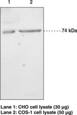 PLA2G6 / IPLA2 Antibody - Western blot of PLA2G6 antibody.