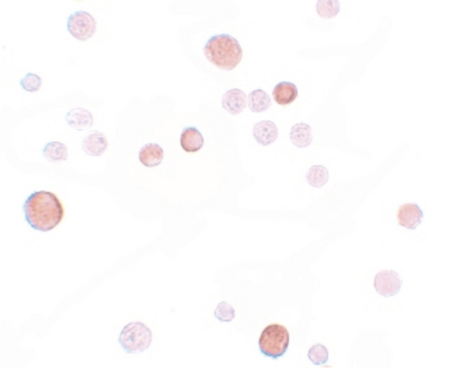 PLAC1 Antibody - Immunocytochemistry of PLAC1 in HeLa cells with PLAC1 antibody at 10 ug/ml.