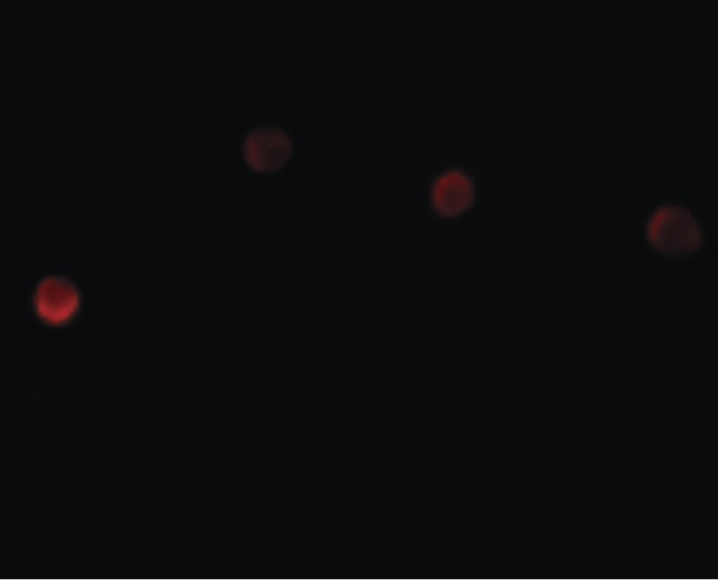 PLAC1 Antibody - Immunofluorescence of PLAC1 in HeLa cells with PLAC1 antibody at 20 ug/ml.