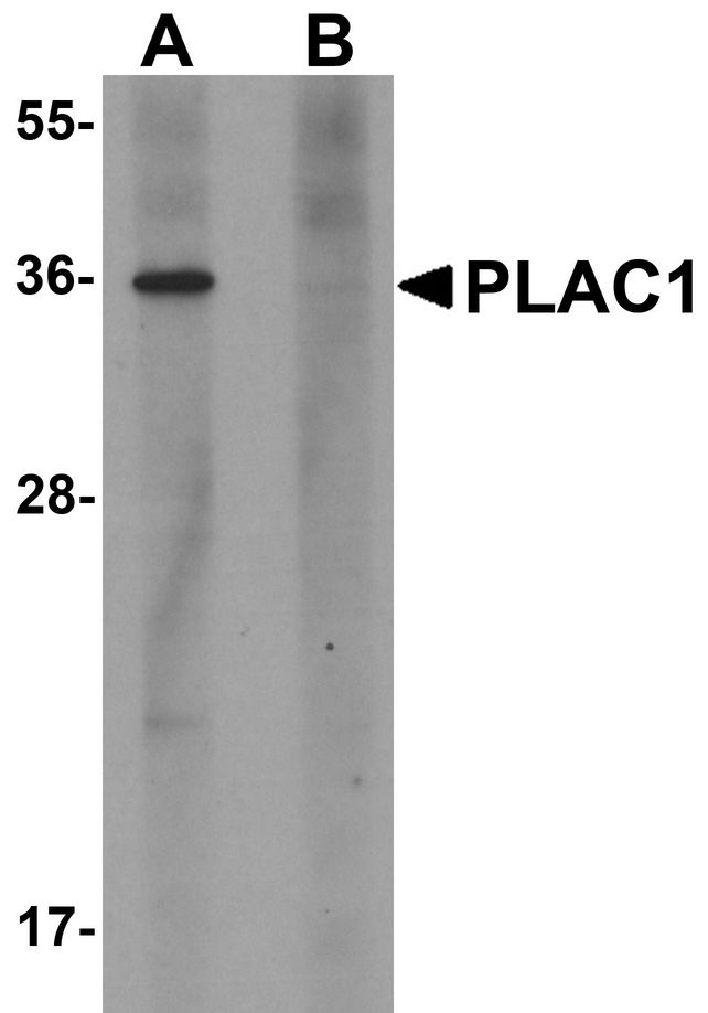 PLAC1 Antibody - Western blot analysis of PLAC1 in human placenta tissue lysate with PLAC1 antibody at 1 ug/ml in (A) the absence and (B) the presence of blocking peptide.