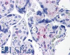 PLAC1 Antibody - Anti-PLAC1 antibody IHC of human placenta. Immunohistochemistry of formalin-fixed, paraffin-embedded tissue after heat-induced antigen retrieval. Antibody concentration 5 ug/ml.