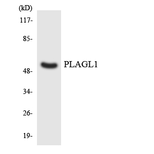 PLAGL1 / ZAC Antibody - Western blot analysis of the lysates from HeLa cells using PLAGL1 antibody.