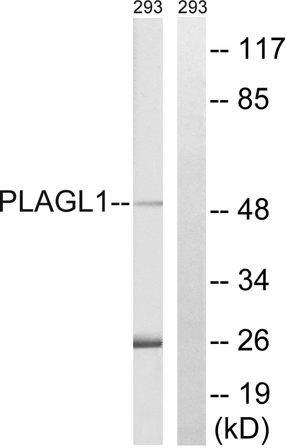 PLAGL1 / ZAC Antibody - Western blot analysis of lysates from 293 cells, using PLAGL1 Antibody. The lane on the right is blocked with the synthesized peptide.