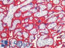 PLAP / Alkaline Phosphatase Antibody - Human Placenta: Formalin-Fixed, Paraffin-Embedded (FFPE)
