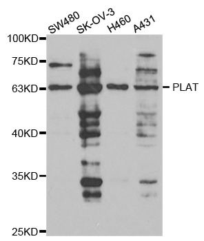 PLAT / TPA Antibody - Western blot analysis of extracts of various cell lines, using PLAT antibody.