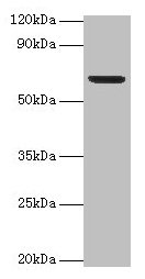 PLBD2 Antibody - Western blot All lanes: Putative phospholipase B-like 2 antibody at 2µg/ml + Mouse brain tissue Secondary Goat polyclonal to rabbit IgG at 1/15000 dilution Predicted band size: 67, 50 kDa Observed band size: 67 kDa