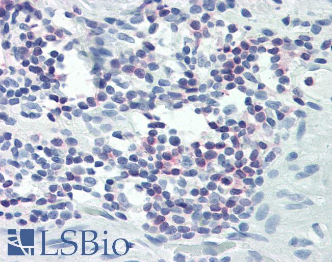 PLCG1 Antibody - Anti-PLCG1 antibody IHC of human colon, lymphocytes. Immunohistochemistry of formalin-fixed, paraffin-embedded tissue after heat-induced antigen retrieval. Antibody dilution 1:25.