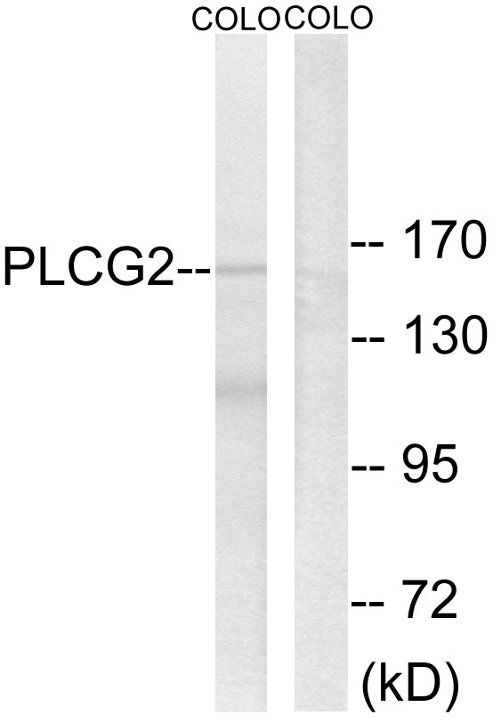 PLCG2 / PLC Gamma 2 Antibody - Western blot analysis of lysates from COLO205 cells, using PLCG2 Antibody. The lane on the right is blocked with the synthesized peptide.